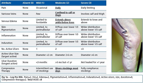 figure 1a