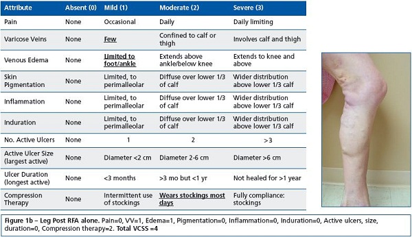 Figure 1b