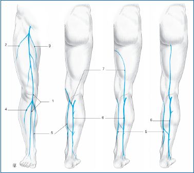 [Surgical techniques used for the treatment of varicose veins: survey of practice in France]