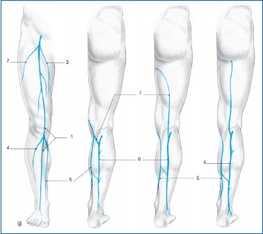 chirurgie varicose ven