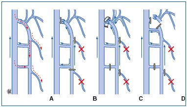 Figure 18A/B/C/D