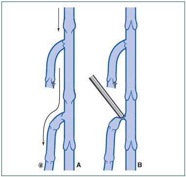 Figure 19 