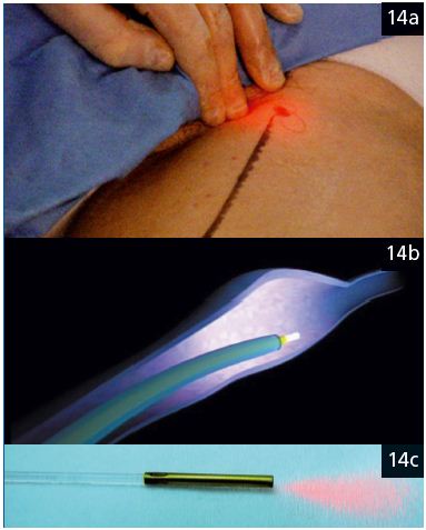 Figure 14a/b/c