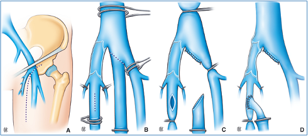 Figure 30