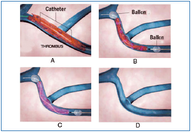 Figure 22