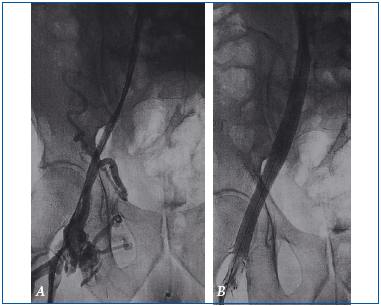 Figure 25