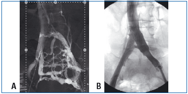 Figure 26