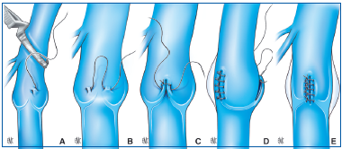 Figure 28