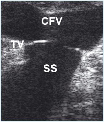 Figure 2a