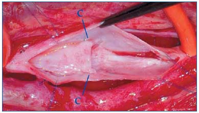 Figure 2 Figure 2
