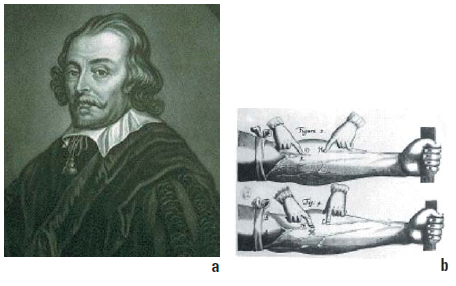 Figure 1 Figure 1
