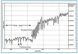 Figure 4 Figure 4