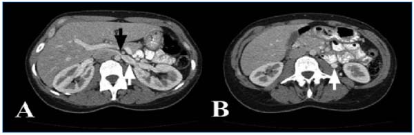 Figure 3 Figure 3