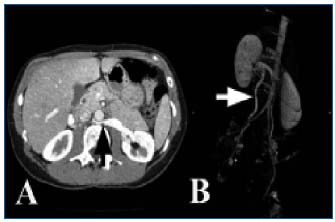 Figure 4 Figure 4
