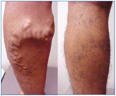 Figure 1 Figure 1