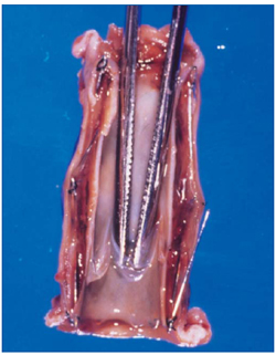 Figure 2 Figure 2
