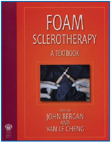 FOAM SCLEROTHERAPY