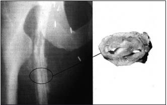 Figure 12 Figure 12