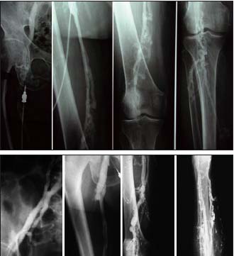 Figure 3 and 3b