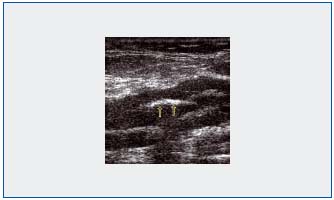Figure 1 Figure 1