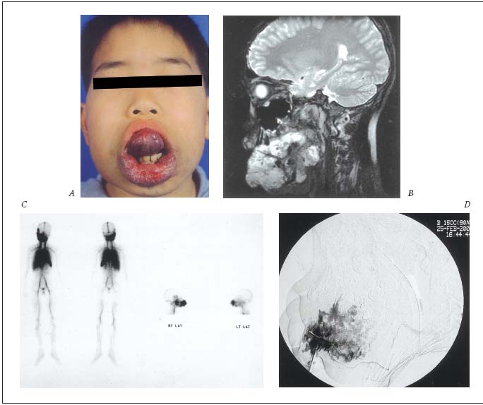 Figure 1-A