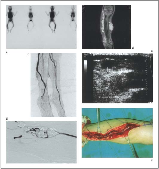 Figure 1-B