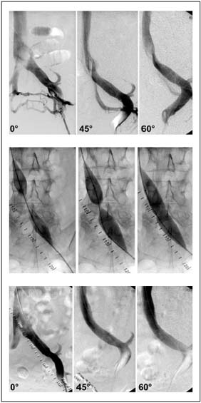 Figure 1a-c