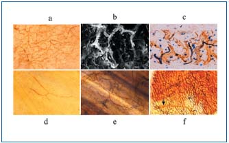 Figure 1 (a, b, c, d, e, f,)