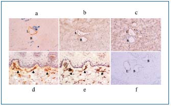 Figure 2 (a, b, c, d, e, f)