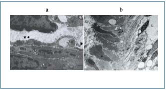 Figure 1 (a, b)