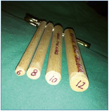 Figure 2. Wooden reference dowels to illustrate the diameter (mm) of varicose veins. Allows physicians to determine the diameter of a palpable varicose vein in comparison with a reference standard (Photo ACT).