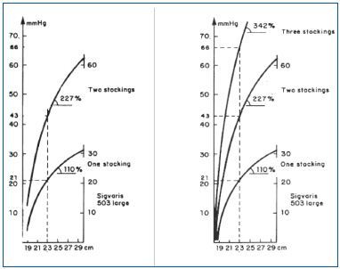 Figure 6. Hysteresis curves for one, two, and three layered medical compression stockings. The pressures are additive. One medical compression stocking on an ankle with a perimeter of 23 cm gives a pressure of ±20 mmHg; two stockings provide a pressure of ±42 mmHg, and a third stocking raises the pressure to ±66 mmHg.