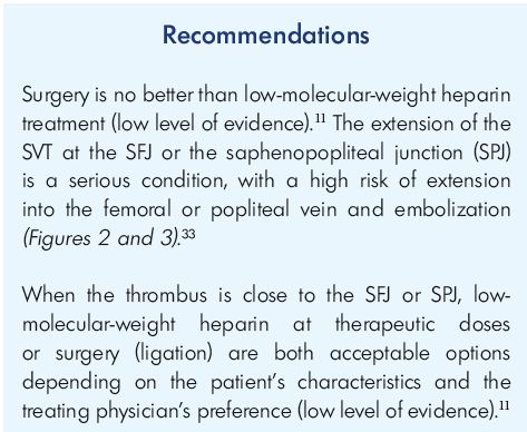 thrombophlebitis treatment