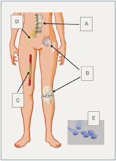 Understanding Chronic Venous Disease: Causes and Symptoms