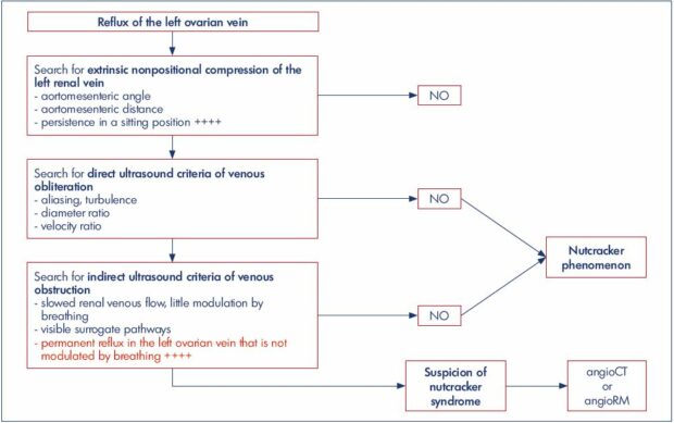 Decisional ultrasound algorithm in the management of nutcracker syndrome, in the context of pelvic varicose veins