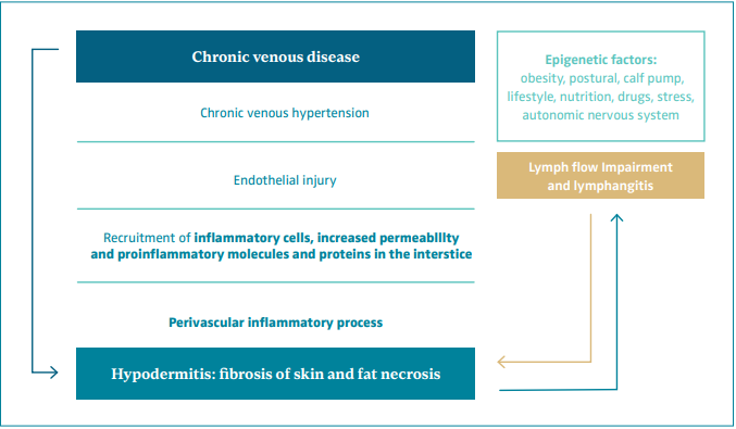 Management Of Hypodermitis Or Lipodermatosclerosis: An Up-To-Date ...